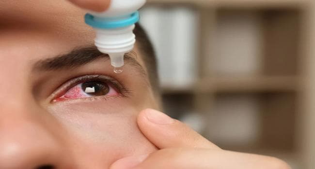 Ophthalmologist warns of eye outbreak in Tunisia