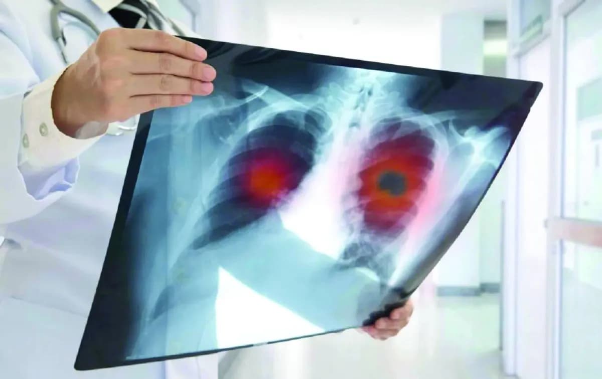 دراسة تُبرز سلامة الحمل بعد علاج بالخلايا التائية المعدلة