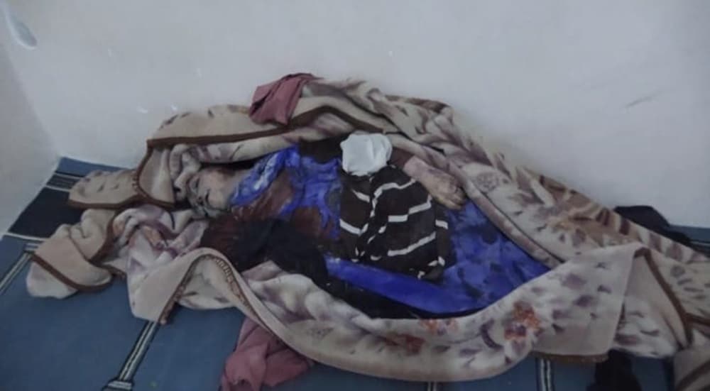 Yemen Saada Clash Leaves Girl Dead
