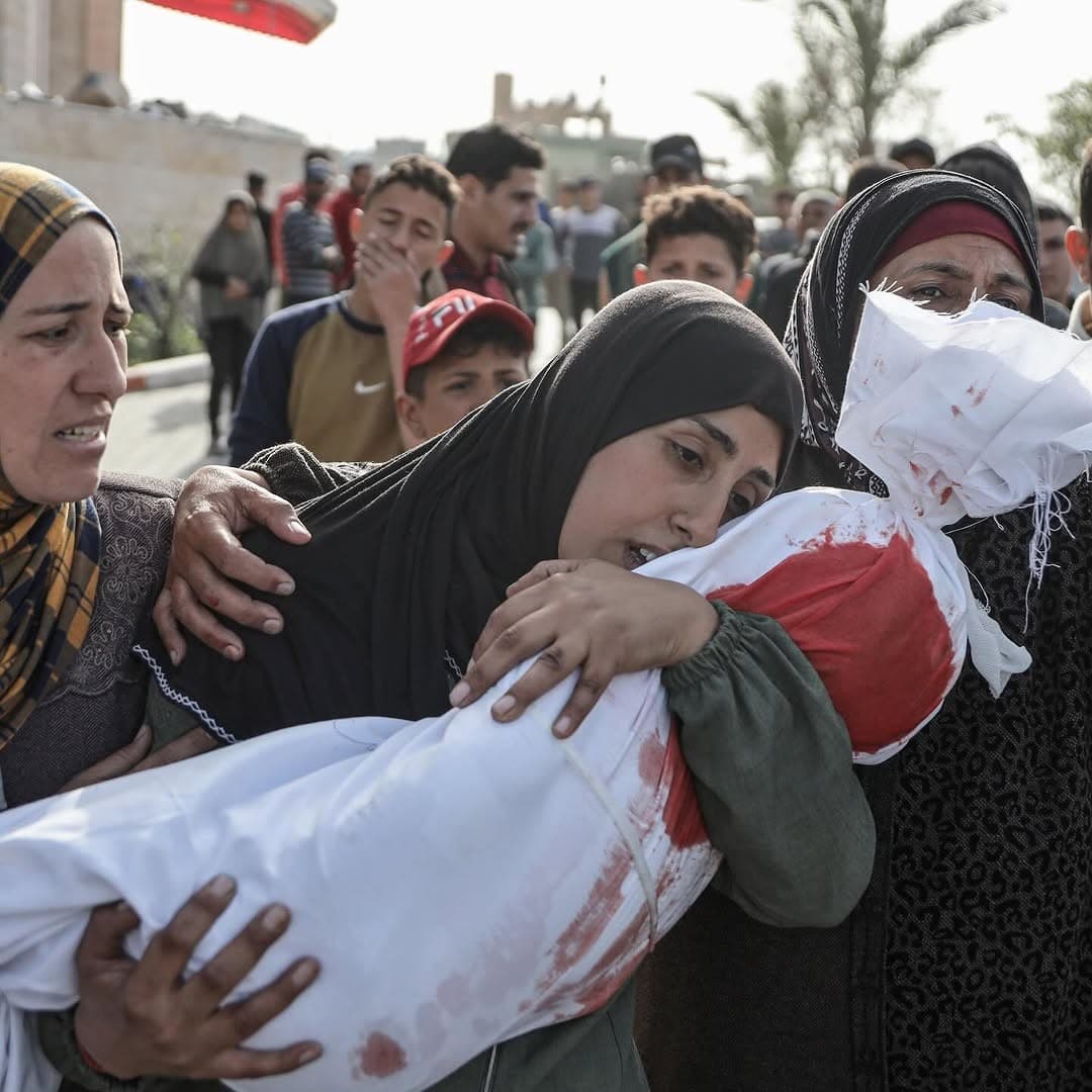 Gaza Strikes Injure and Kill Al-Sabeel