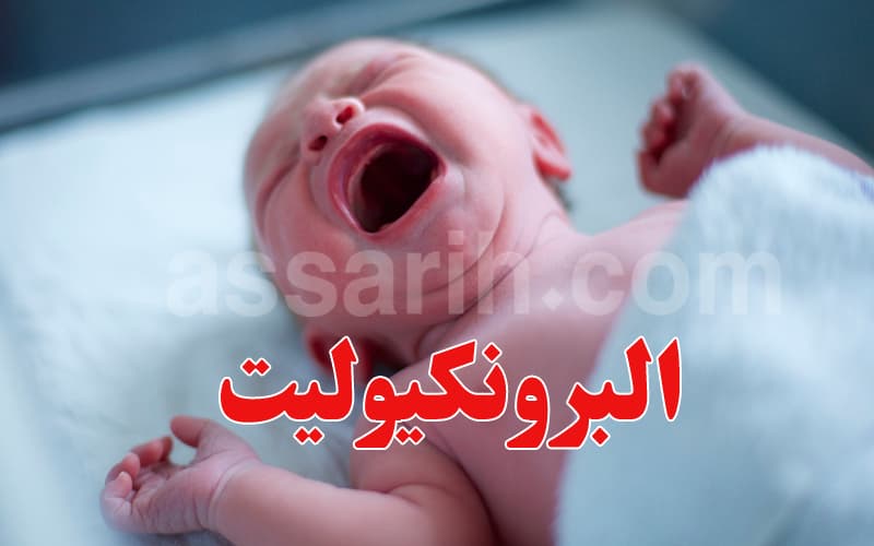 نصائح طبية لحماية الرُضع من البرونكيوليت في الشتاء