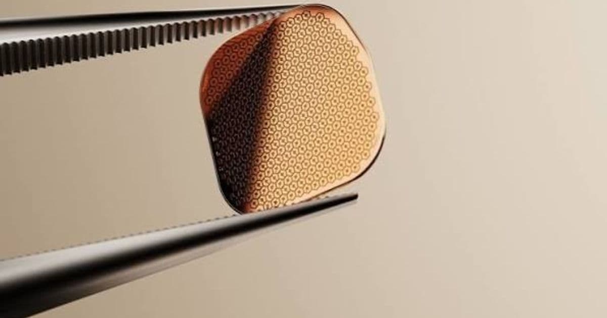 Smart chip restores vision in eye atrophy patient