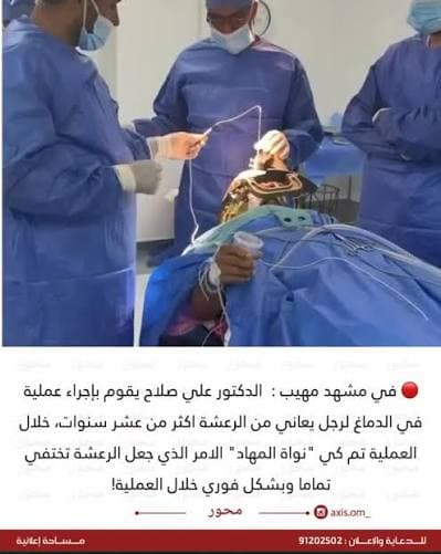 استشاري يوضح علاج الرعاش خلال اليقظة