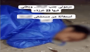 مستشفى بالغردقة وطرد مريض بالإيدز