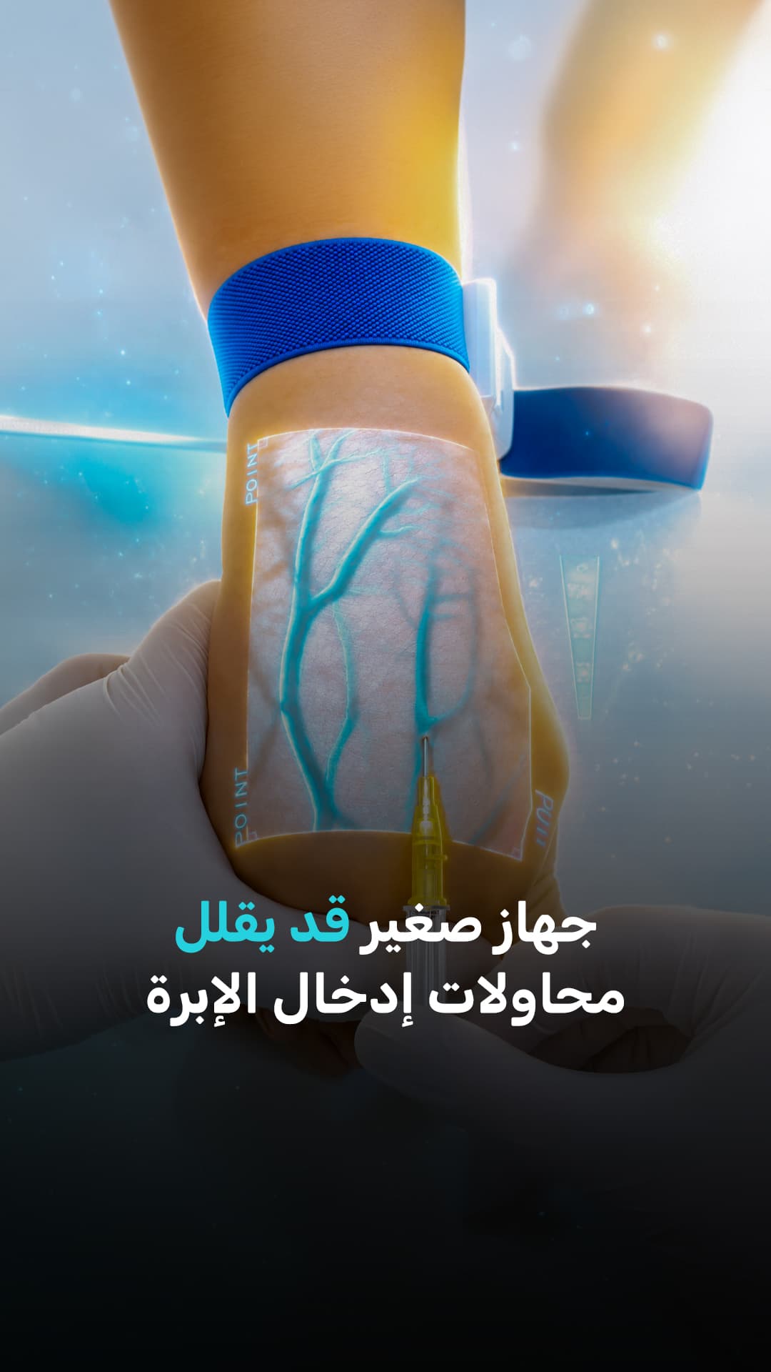 جهاز صغير يقلل محاولات الإدخال