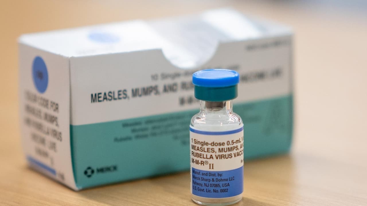Measles case prompts Nassau clinic alert