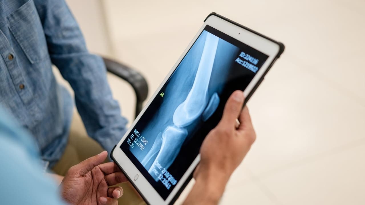 Patients often misinterpret online records