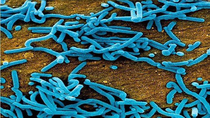 Dormant viruses reactivated post COVID
