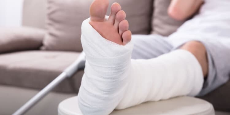 ممثل مشهور يصاب بكسر في قدميه