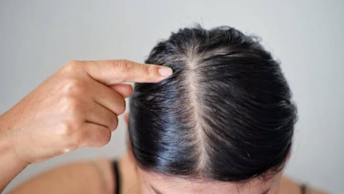 Common causes of quick oiliness in hair