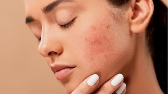 Routine habits may heighten skin irritation