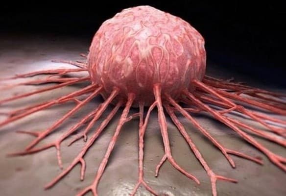 زيادة خطر سرطان القولون مع الإفراط في هذا