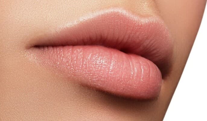 Tips to heal severely chapped lips