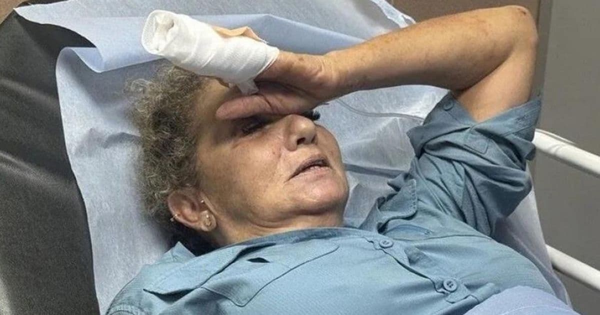 Photographer Denies Netanyahu's Claims on West Bank Attack