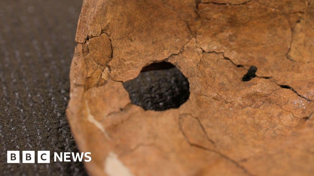 Neanderthal shoulder bone damage from ancient spear