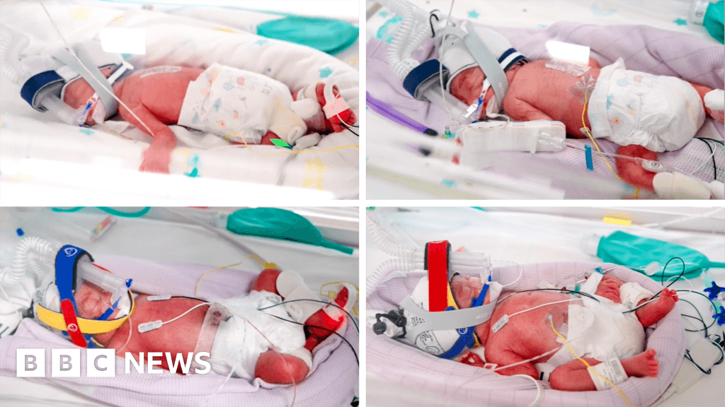 Australia sees rare identical quadruplets