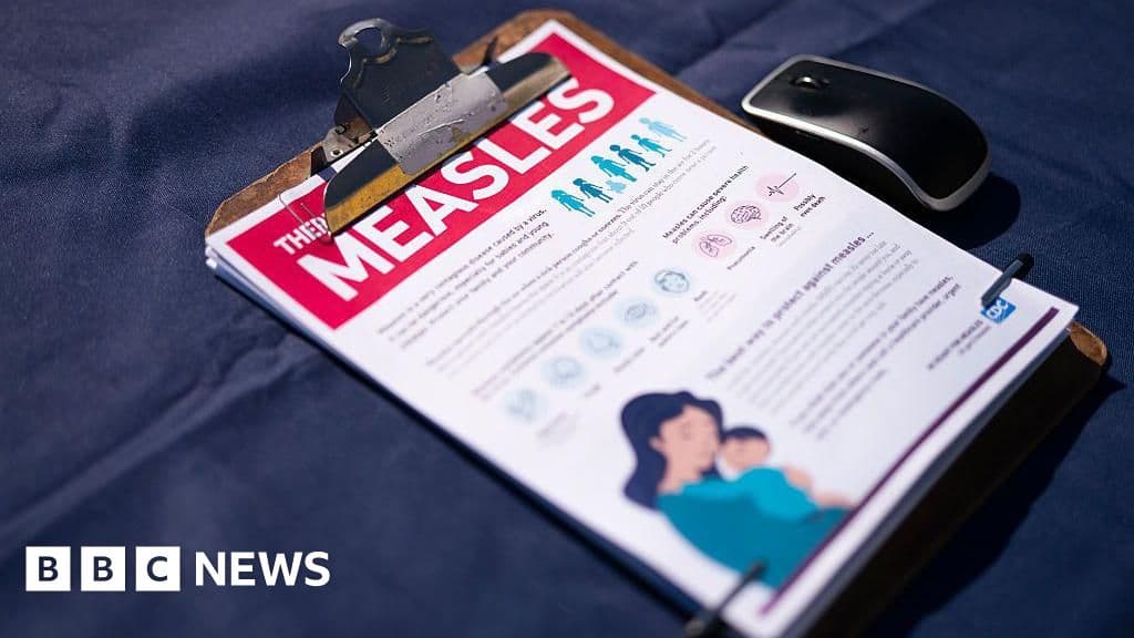 US reports 35-year high measles cases