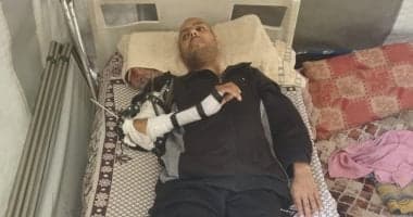 محمد خضر يواجه معركة لإنقاذ أطرافه