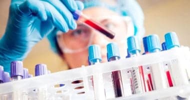 AI predicts pancreatic cancer risk 5 years early