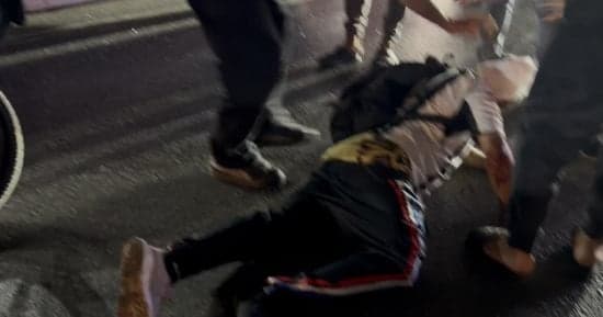 حادث دهس في الدقي يوقع إصابة خطيرة
