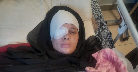 ناجية من دمار غزة تطلب علاج خارج البلاد