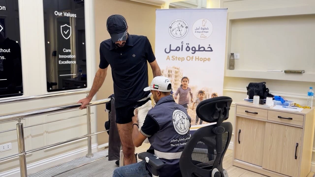 المستشفى الإماراتي يعالج فلسطينيين بـ42 طرفًا صناعيًا