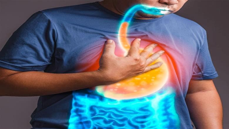 خمس طرق لعلاج حرقة المعدة صباحًا