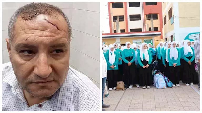 ولي أمر يطارد مدير مدرسة ويصيبها ب17 غرزة