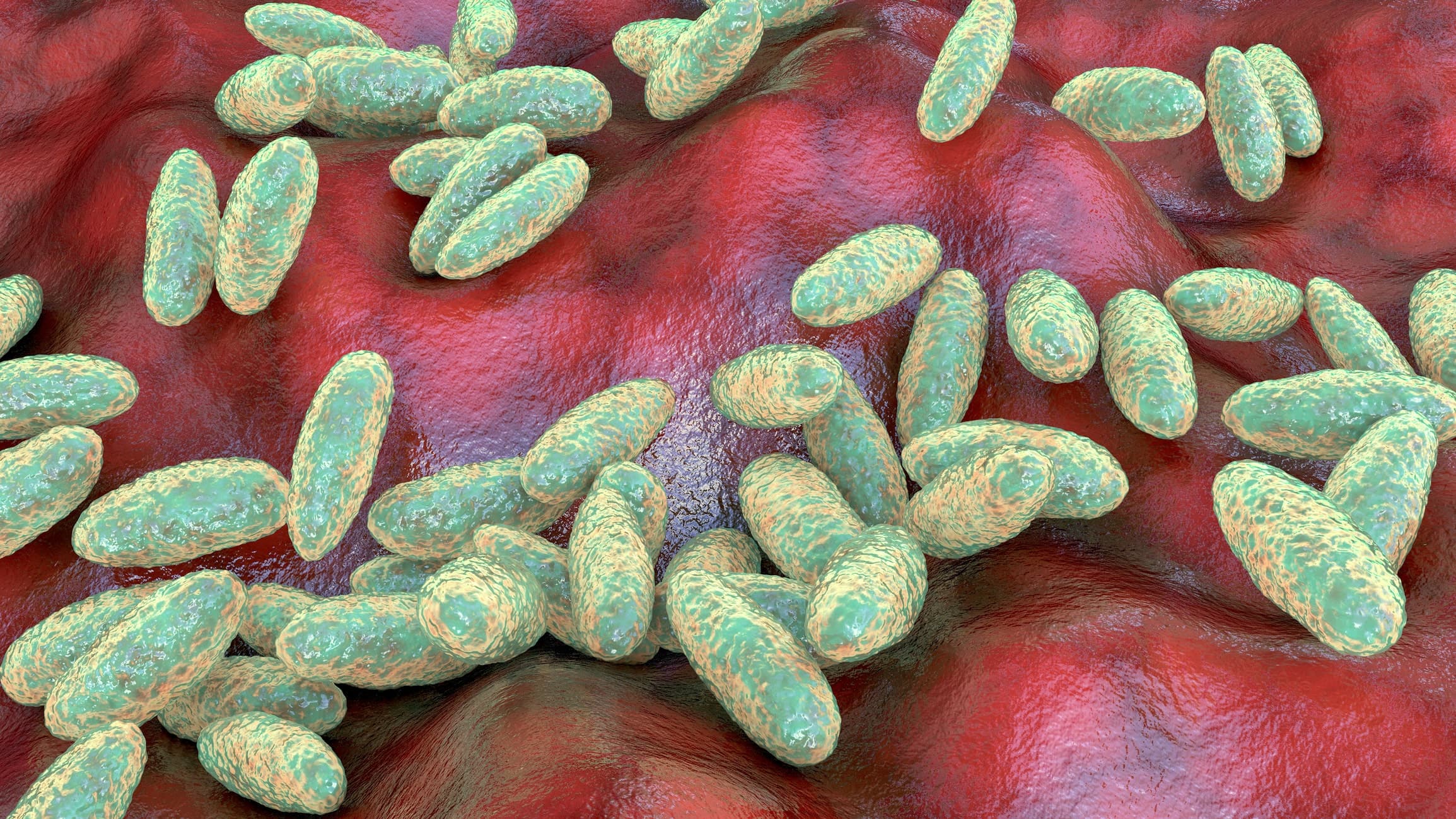 US watches suspected pneumonic plague in Russia