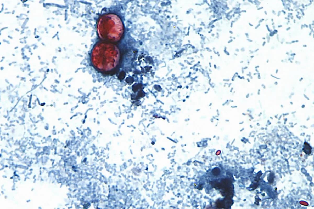 Cyclospora's Entry into the Small Intestine