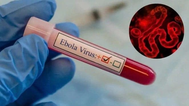 إيبولا يتفشى بسرعة قياسية