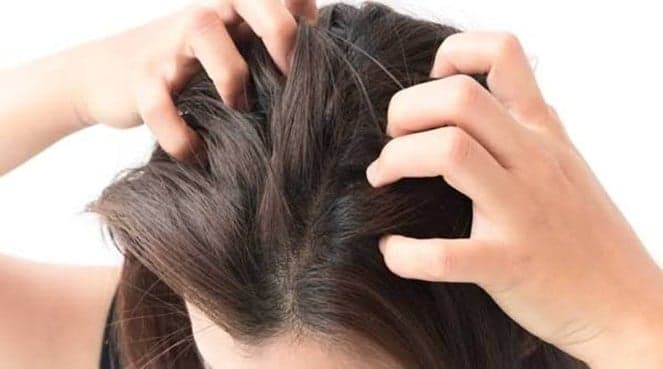 لماذا تزداد حكة فروة الرأس ليلا