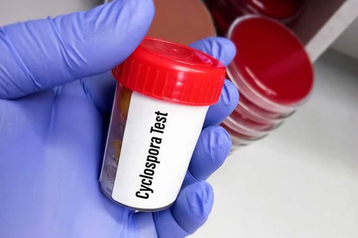 One Thousand Cases of Parasitic Infection Reported in Michigan, USA