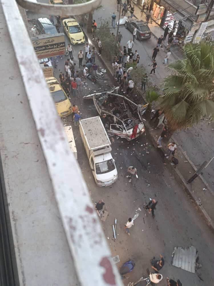 Jaramana bus bomb injuries