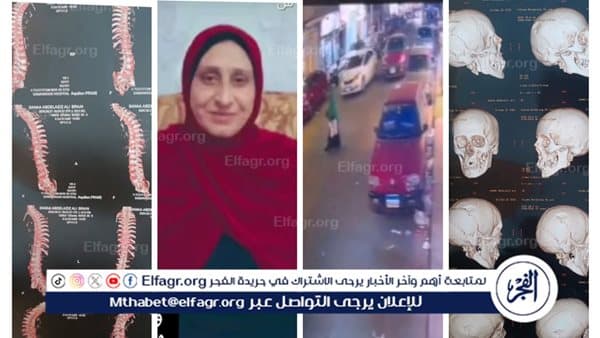 أسرة مسنة تتعرض للدهس بدمنهور