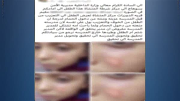 ولية أمر تتهم معلمة بالاعتداء على تلميذ