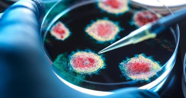 Russia's plague alarm highlights global epidemic preparedness