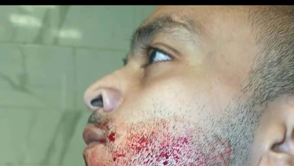 شاب يشتكي من خاله لبيعه الورث وتهديده بالسلاح